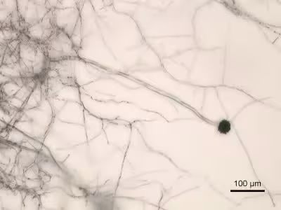 Aspergillus_niger_Micrograph