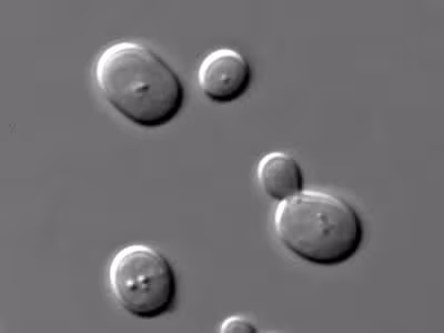 S_cerevisiae_under_DIC_microscopy
